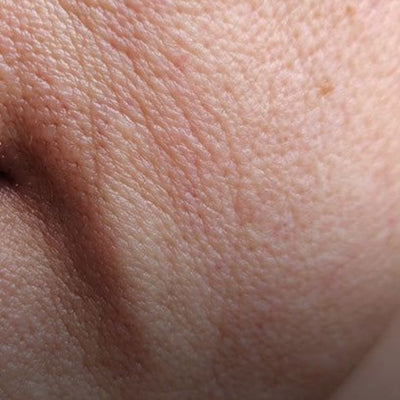 Texture de peau et ridules