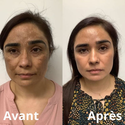 Novaface™ Baume Teinté Effet Peau Parfaite