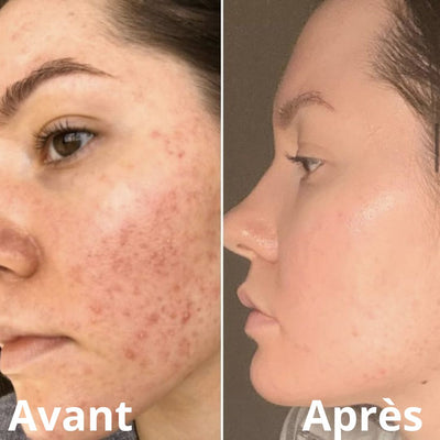 Novaface™ Baume Teinté Effet Peau Parfaite