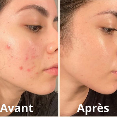 Novaface™ Baume Teinté Effet Peau Parfaite